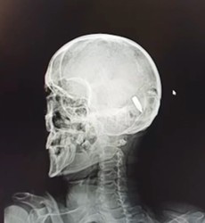 JPG Image, 59KB, 744px × 808px